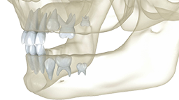 Cirugía oral
